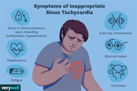 Inappropriate Sinus Tachycardia Causes And Treatment