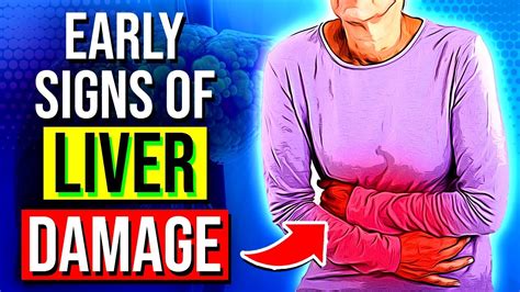 Don T Ignore These 6 Warning Signs Of Liver Damage Before It S Too Late Youtube
