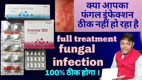 Fungal Infection Full Treatment Fungal Infection Symptoms Reason And