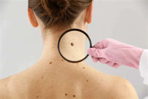 The Most Common Skin Conditions And Their Cures