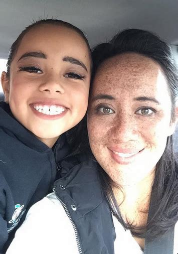 Mom Bullied For Contagious Freckles Finally Embraces Self See Her