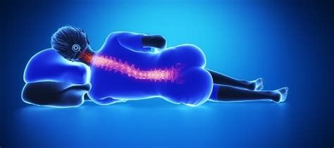 How To Sleep With Piriformis Syndrome And Sciatica Best Sleeping