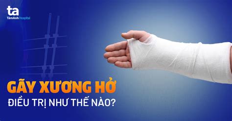 Gãy xương hở Nguyên nhân triệu chứng và cách điều trị