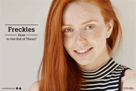 Freckles How To Get Rid Of Them By Dr Parul Jaiswal Lybrate