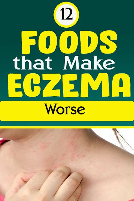 12 Foods That Make Eczema Worse Beautyhealthycare