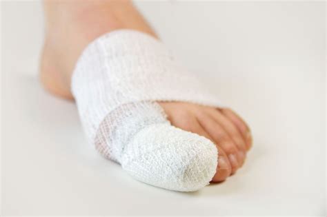 Surgical Intervention Indianapolis In Northeast Foot And Ankle