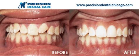 You can look at the address on the map. Precision Dental Care | The Best Dentists in Chicago IL