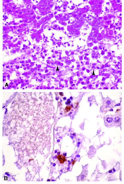 A Granulomatous Hepatitis In Neospora Caninum Experimentally Infected