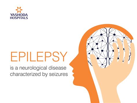 Epilepsy Seizures Or Fits Symptoms Causes And Treatment