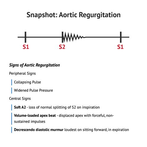 Aortic Regurgitation Marfan Syndrome Bicuspid Aortic Valve Pulse