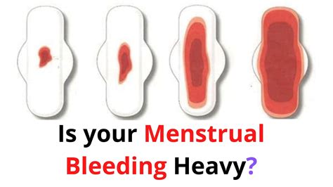 What Are Reasons Less Bleeding During Periods