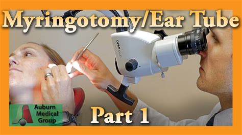 Myringotomy And Ear Tube Part 1 Feat Dr Tim Fife Myringotomy Auburn