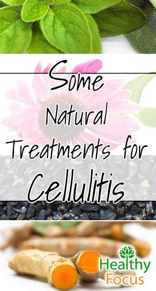 10 Proven Natural Treatments For Cellulitis Healthy Focus