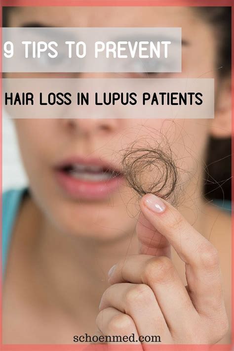 9 Tips To Prevent Hair Loss In Lupus Patients Schoen Med Lupus Hair