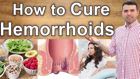 Piles Haemorrhoids Causes Symptoms And Treatment