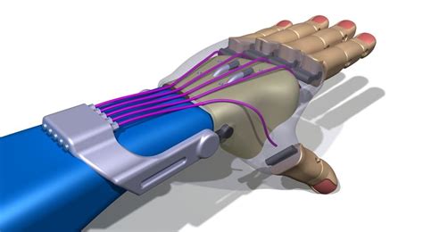 Next Generation Of 3d Printed Prosthetic Hands The Flexy Hand 2