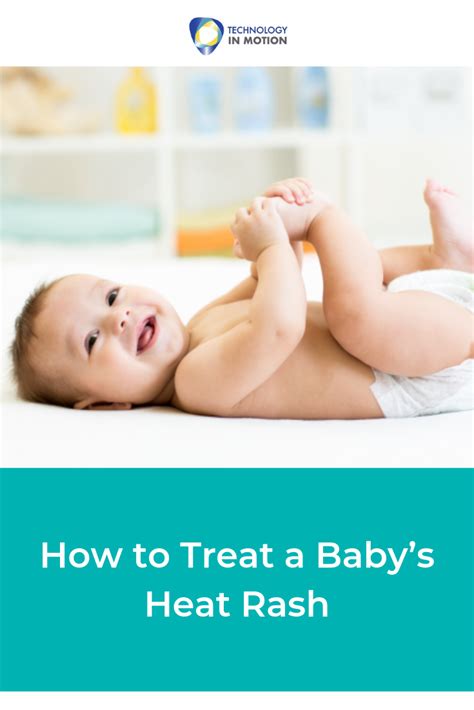 How To Treat A Babys Heat Rash Baby Heat Rash Heat Rash Rash Treatment