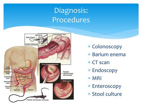 PPT Nutritional Management Of Crohns Disease PowerPoint Presentation ID