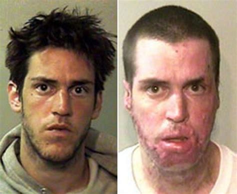 Shocking before and after pics of crystal meth junkies - Daily Star