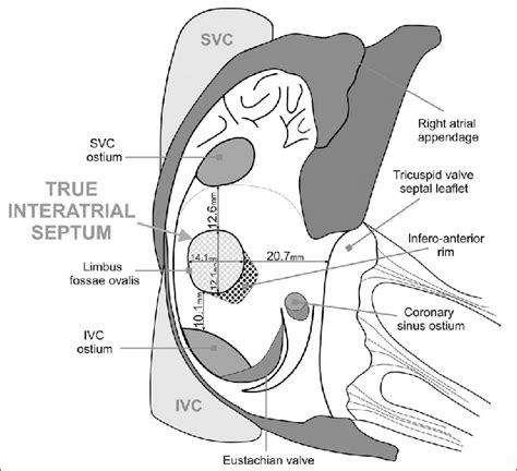 Interatrial Septum