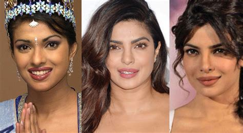 Priyanka Chopra Plastic Surgery Before And After Pictures 2024