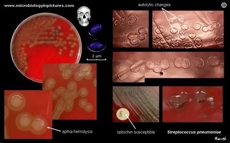 Streptococcus Pneumoniae Colony Morphology And Microscopic Appearance