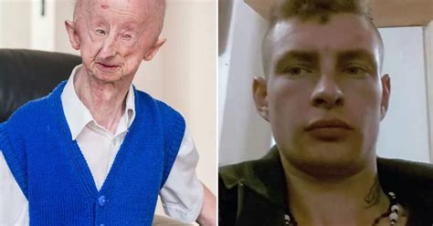 Alan Barnes Disabled Oap Urges Lengthy Jail Term For Drug Addict