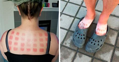 79 Times People Underestimated The Power Of The Sun And Got Seriously