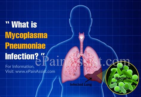 What Is Mycoplasma Pneumoniae Infection Know Its Symptoms And