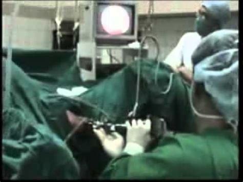 Turp Transurethral Resection Of The Prostate Sample Video Youtube