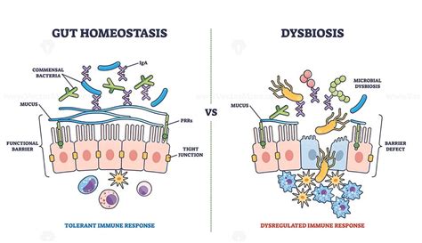 Gut Homeostasis And Dysbiosis Immune Response Differences Outline