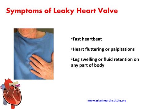 Asian Heart Institute Leaky Heart Valve Symptoms Ppt