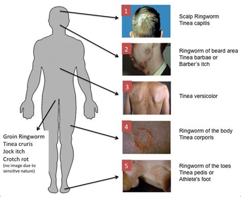 More images for different body parts and different diseases of human body » Dr Ajays Homeopathy : Homeopathy is Best for Recurrent ...