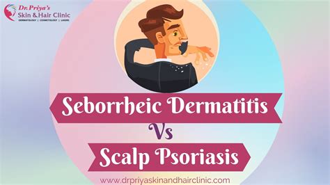 Psoriasis Vs Seborrheic Dermatitis Whats The Difference 289