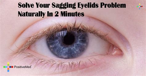 Solve Your Sagging Eyelids Problem Naturally In 2 Minutes Positivemed