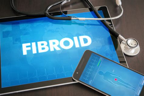 Everything Women Need To Know About Fibroids Facty Health