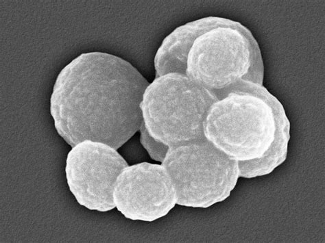 Mycoplasma Sp Photograph By Dennis Kunkel Microscopyscience Photo