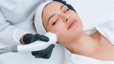 Benefits Of A Sciton Halo Laser Treatment