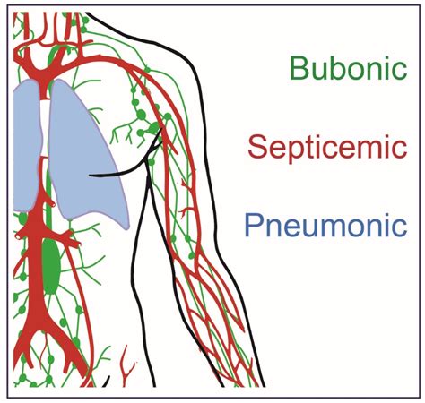 Biomedicines Free Full Text Plague Prevention And Therapy