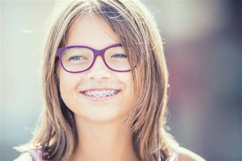 Portrait Of A Happy Smiling Teenage Girl With Dental Braces And Stock