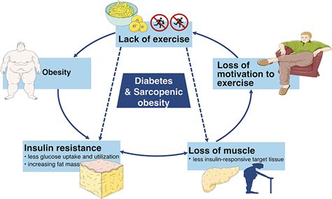 Frontiers Diabetes And Sarcopenic Obesity Pathogenesis Diagnosis And Treatments