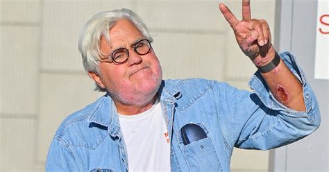 Jay Leno Performs At California Comedy Club 2 Weeks After Burn