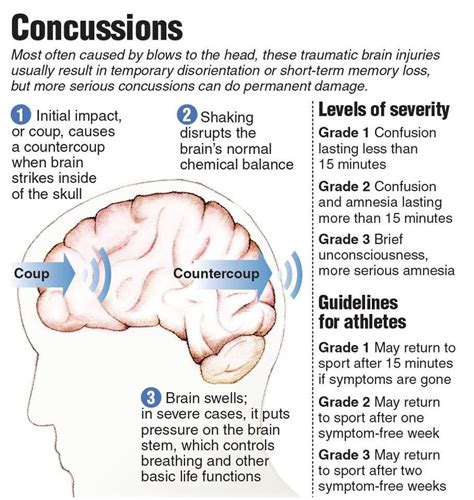 Concussion Effects On Brain Brainlyld