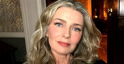 Paulina Porizkova Shares A Candid Selfie Showing Marks On Her Face From A Plasma Treatment