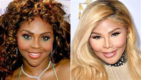 Celebs Who Are Nearly Unrecognizable After Plastic Surgery Mind Your