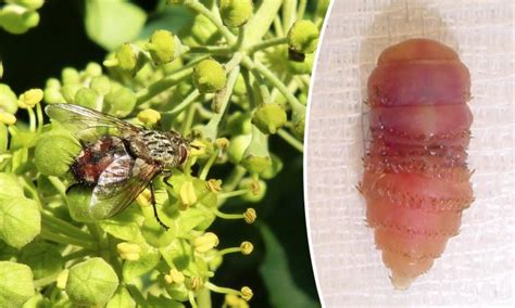 Painful Lumps On Womans Scalp Turn Out To Be Parasitic Botfly Larvae