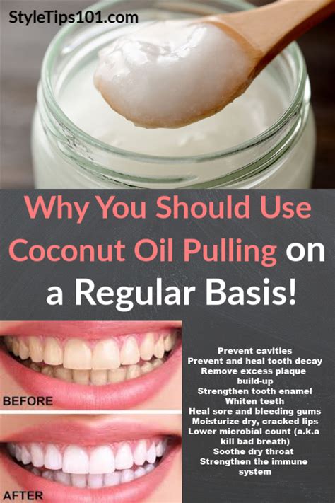 An Ancient Remedy Coconut Oil Pulling Involves Swishing Coconut Oil In Your Mouth For Several