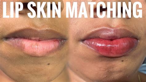100 Lip Vitiligo Treatment Permanent Lip Color Tattoo Machu