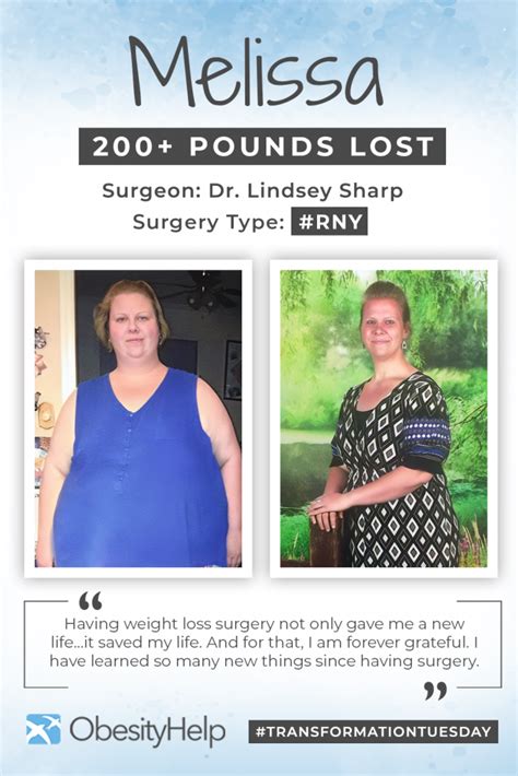 Before And After Rny With Melissa Down 200 Pounds Obesityhelp