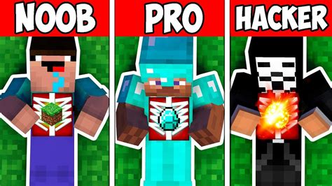 Minecraft Noob Vs Pro Vs Hacker Hospital Challenge In Minecraft Animation Youtube